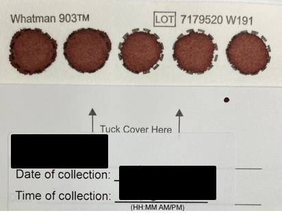 Sample DSB test card